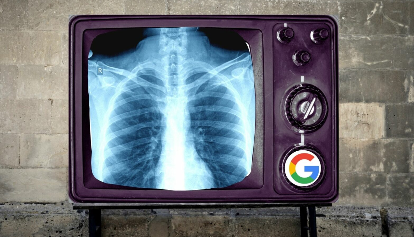 The Future of Medical Diagnosis? Google and DeepMind Unveil Med-Gemini